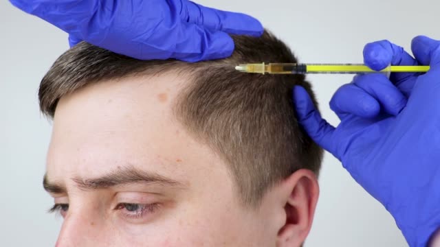 Hair Transplant Istanbul: Step-by-Step Journey to New Confidence